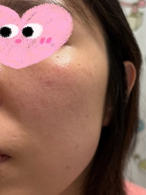 jodidii-Atorrege AD+深層保濕精華 (水繃帶)_2