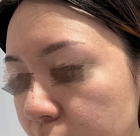 isabeloclock-Atorrege AD+深層保濕精華 (水繃帶)_3