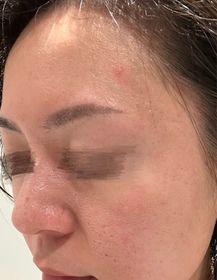 isabeloclock-Atorrege AD+深層保濕精華 (水繃帶)_4