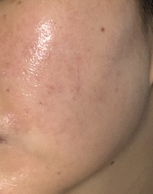 kvet-麗珠蘭 REJURANPDRx 7% 超水光肌膚再生安瓶精華_1