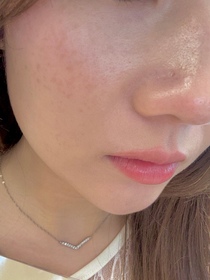 cc-麗珠蘭 REJURANPDRx 7% 超水光肌膚再生安瓶精華_3