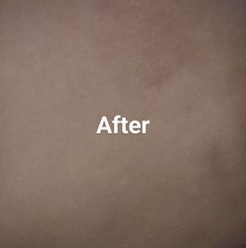 shirleywong-CeraVeSA水楊酸煥膚潔膚露_3