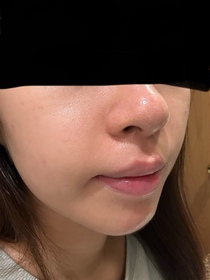 natalieho1202-麗珠蘭 REJURANPDRx 5%強效鎖水機能爽膚水_3