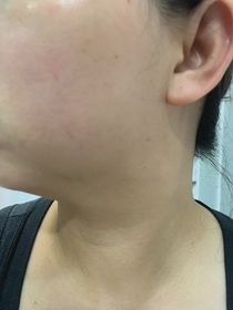 Yuki Chow-麗珠蘭 REJURANPDRx 5%強效鎖水機能爽膚水_2