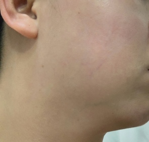 Yuki Chow-麗珠蘭 REJURANPDRx 7% 超水光肌膚再生安瓶精華_3