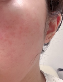 zetalhc-麗珠蘭 REJURANPDRx 5%超水光深層保濕再生修復面膜_1