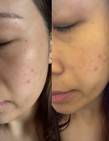 Coyee C.-麗珠蘭 REJURANPDRx 5%強效鎖水機能爽膚水_4