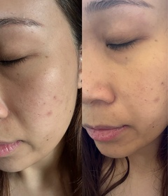 Coyee C.-麗珠蘭 REJURANPDRx 7% 超水光肌膚再生安瓶精華_4