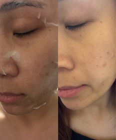 Coyee C.-麗珠蘭 REJURANPDRx 5%超水光深層保濕再生修復面膜_3