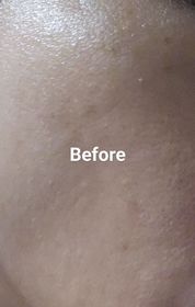 shirleywong-CeraVe去油抗瑕疵白泥潔膚露_3