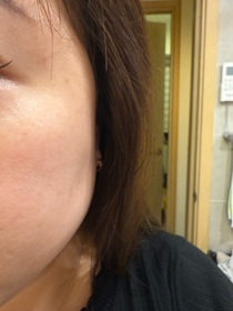 Rainnie-Atorrege AD+深層保濕精華 (水繃帶)_2