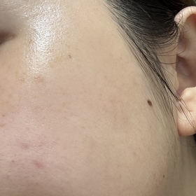 Carcarmen-麗珠蘭 REJURANPDRx 7% 超水光肌膚再生安瓶精華_2