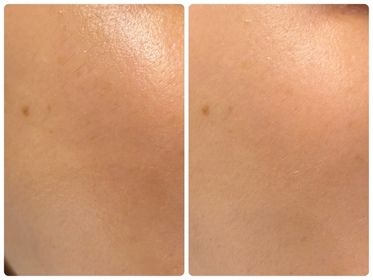 trytryjer-麗珠蘭 REJURANPDRx 7% 超水光肌膚再生安瓶精華_3