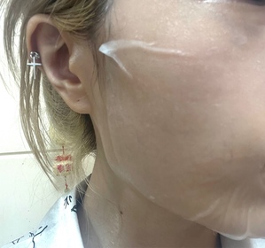 Asteria-麗珠蘭 REJURANPDRx 5%超水光深層保濕再生修復面膜_3