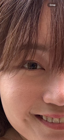 Zoe-麗珠蘭 REJURANPDRx 7% 超水光肌膚再生安瓶精華_1