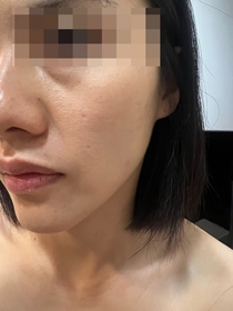 旻珊-CeraVe去油抗瑕疵白泥潔膚露_1