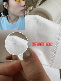 旻珊-CeraVe去油抗瑕疵白泥潔膚露_4