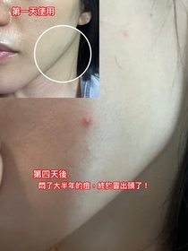 旻珊-CeraVeA醇全效平滑祛印精華_1