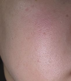 Yuki-Charlotte Tilbury輕盈無瑕粉底液 (NEXT GEN粉底)_1