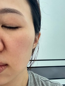 Soda soda-AHC醫美科研水光導入玻尿酸精華 #水光微整精華_1