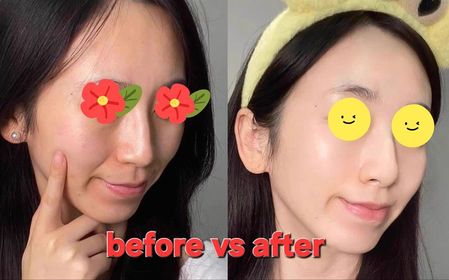 Fng-AHC醫美科研水光導入玻尿酸精華 #水光微整精華_3