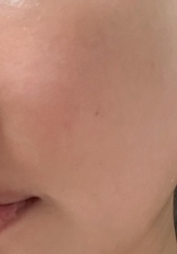 Lam-AHC醫美科研水光導入玻尿酸精華 #水光微整精華_3