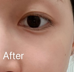 Lam-AHC醫美科研水光導入玻尿酸全臉眼霜 #水光微整全臉眼霜_3