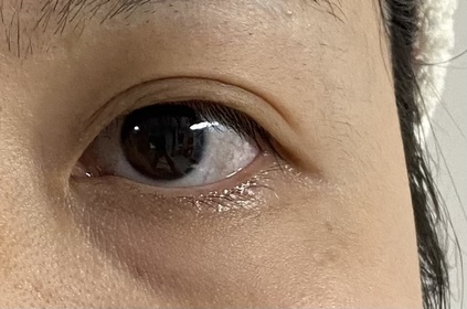 Candy Ng-AHC醫美科研水光導入玻尿酸全臉眼霜 #水光微整全臉眼霜_1