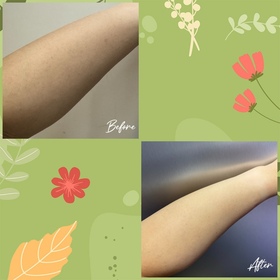 Shirlin Ho-NIVEADERMA CARE科研 舒敏修護雙管精萃凝乳_3
