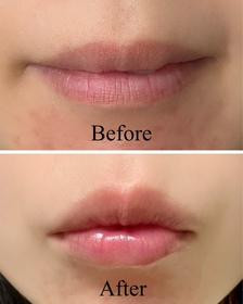 Maggie Wong-MENTHOLATUM 曼秀雷敦LIP PURE 蜂蜜潤唇膏_1