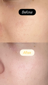 Wendy-AHC醫美科研水光導入玻尿酸全臉眼霜 #水光微整全臉眼霜_3