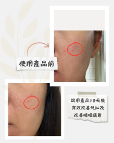 mandyf128-AHC醫美科研水光導入玻尿酸精華 #水光微整精華_2