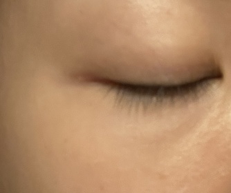 Kirby-AHC醫美科研水光導入玻尿酸全臉眼霜 #水光微整全臉眼霜_1