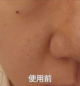 lovemon222-AHC醫美科研水光導入玻尿酸全臉眼霜 #水光微整全臉眼霜_2