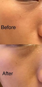 Imelda -AHC醫美科研水光導入玻尿酸全臉眼霜 #水光微整全臉眼霜_3