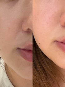 Yvonne-CLARINS賦活雙萃精華_2
