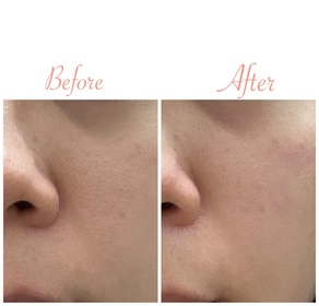 PSiLoveu-CLARINS賦活雙精華Double Serum_4