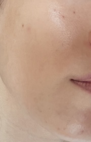 Kirby-LA ROCHE-POSAYB5修復強韌精華_1