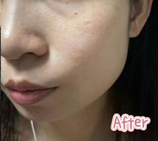 Samantha To-CAUDALIE白藜蘆醇提昇緊緻精華_3