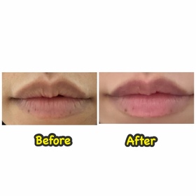 Fanc-MENTHOLATUM 曼秀雷敦LIP PURE 蜂蜜潤唇膏_4