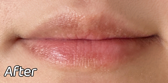 isabeloclock-MENTHOLATUM 曼秀雷敦LIP PURE 蜂蜜潤唇膏_1