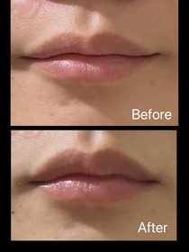 mavvv-MENTHOLATUM 曼秀雷敦LIP PURE 蜂蜜潤唇膏_1
