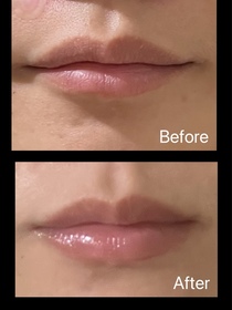 mavvv-MENTHOLATUM 曼秀雷敦LIP PURE 天然植物潤唇膏(無香料)_1