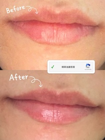 Bchonfrise -MENTHOLATUM 曼秀雷敦LIP PURE 蜂蜜潤唇膏_2