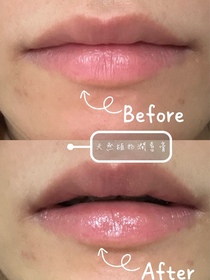 Bchonfrise -MENTHOLATUM 曼秀雷敦LIP PURE 蜂蜜潤唇膏_4