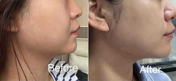 Amy-OLAY胜肽專研緊緻滋潤面霜_1