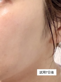 alice-CAUDALIE白藜蘆醇提昇緊緻精華_2