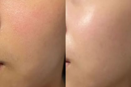 Kitty -OLAY胜肽專研緊緻修護安瓶精華_3