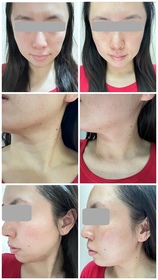 karen-OLAY胜肽專研緊緻修護安瓶精華_3