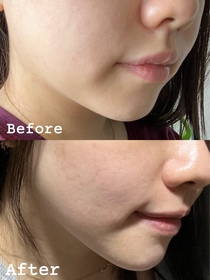 bbbcls-OLAY胜肽專研緊緻修護安瓶精華_1